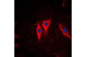 Immunofluorescent analysis of Cytokeratin 5 staining in HeLa cells.