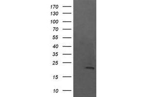 Image no. 1 for anti-NFKB Inhibitor Interacting Ras-Like 1 (NKIRAS1) antibody (ABIN1499741)