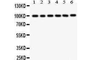 Image no. 3 for anti-Stromal Interaction Molecule 1 (STIM1) (AA 45-74), (N-Term) antibody (ABIN3043940)