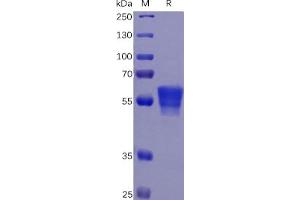 Image no. 1 for CD7 (CD7) protein (mFc Tag) (ABIN6961151)