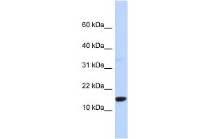 Image no. 1 for anti-Tumor Protein D52-Like 3 (TPD52L3) (Middle Region) antibody (ABIN2787805)
