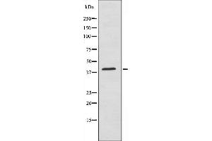 Image no. 3 for anti-V-Maf Musculoaponeurotic Fibrosarcoma Oncogene Homolog (Avian) (MAF) (C-Term) antibody (ABIN6259098)
