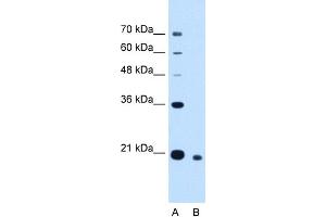 anti-Cell Division Cycle Associated 4 (CDCA4) (N-Term) antibody
