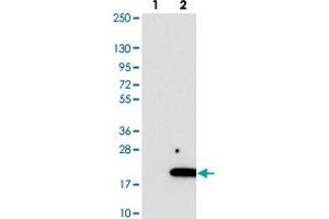 Image no. 1 for anti-Chromosome 2 Open Reading Frame 76 (C2ORF76) antibody (ABIN5649693)