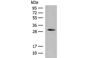 Western blot analysis of Human left thymus tissue lysate using VDAC3 Polyclonal Antibody at dilution of 1:200