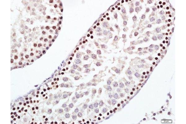 ERCC1 antibody  (AA 151-250)