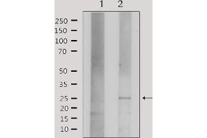 Image no. 3 for anti-Claudin 3 (CLDN3) antibody (ABIN6260865)