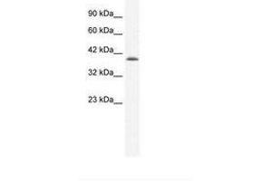 Image no. 2 for anti-Cation Channel, Sperm Associated 2 (CATSPER2) (AA 31-80) antibody (ABIN203121)
