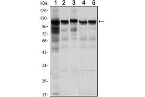 Image no. 3 for anti-Hexokinase 1 (HK1) antibody (ABIN1843870)
