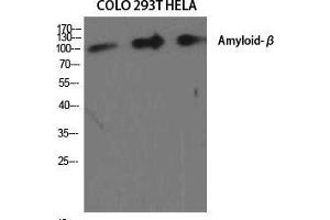 Image no. 2 for anti-Amyloid beta (Abeta) (Ser15) antibody (ABIN3183281)