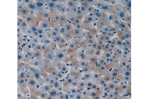 Used in DAB staining on fromalin fixed paraffin-embedded Liver tissue