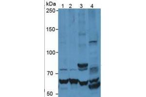 Image no. 4 for Matrix Metallopeptidase 9 (Gelatinase B, 92kDa Gelatinase, 92kDa Type IV Collagenase) (MMP9) ELISA Kit (ABIN6730943)