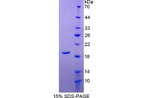 Image no. 1 for Superoxide Dismutase 1, Soluble (SOD1) (AA 2-153) protein (His tag) (ABIN6238035)