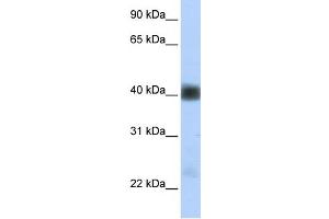 Image no. 1 for anti-Sarcoglycan, beta (43kDa Dystrophin-Associated Glycoprotein) (SGCB) (Middle Region) antibody (ABIN2781779)
