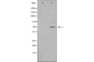Image no. 1 for anti-Thymidine Phosphorylase (TYMP) (N-Term) antibody (ABIN6265823)