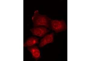 Image no. 2 for anti-Autophagy Related 16-Like 2 (ATG16L2) (Internal Region) antibody (ABIN6259551)