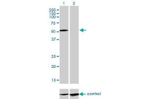 Image no. 3 for anti-Interleukin 13 Receptor, alpha 2 (IL13RA2) (AA 27-126) antibody (ABIN561476)