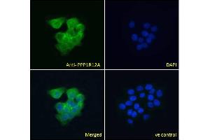 Image no. 3 for anti-Myosin Phosphatase, Target Subunit 1 (PPP1R12A) (C-Term) antibody (ABIN6391349)