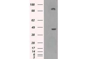 Image no. 2 for anti-Lysyl Oxidase (LOX) (AA 22-168) antibody (ABIN2725058)