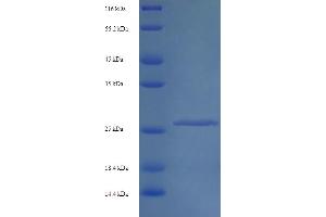 Image no. 1 for Interferon alpha/beta Receptor 2 (IFNAR2) (AA 22-242) protein (His tag) (ABIN5713534)