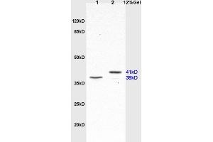 Image no. 5 for anti-Surfactant Protein D (SFTPD) (AA 301-375) antibody (ABIN731678)
