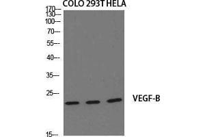Image no. 2 for anti-Vascular Endothelial Growth Factor B (VEGFB) (Internal Region) antibody (ABIN3187464)