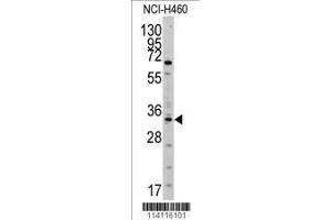 Image no. 1 for anti-Y Box Binding Protein 1 (YBX1) (AA 58-87), (N-Term) antibody (ABIN390262)