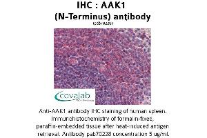 Image no. 2 for anti-AP2 associated kinase 1 (AAK1) (N-Term) antibody (ABIN1731399)