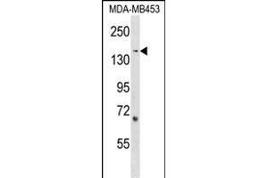 ARHGEF11 Antibody (Center) (ABIN1538531 and ABIN2848595) western blot analysis in MDA-M cell line lysates (35 μg/lane).