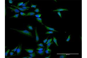 Immunofluorescence of purified MaxPab antibody to INPP5B on HeLa cell.