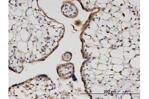 Immunoperoxidase of monoclonal antibody to HOOK3 on formalin-fixed paraffin-embedded human placenta.