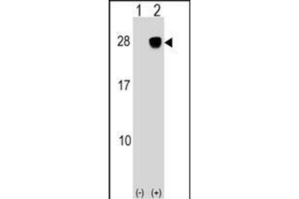 ULBP2 抗体  (AA 88-116)