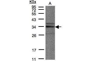 Image no. 2 for anti-NEK7 (NEK7) (C-Term) antibody (ABIN2856578)