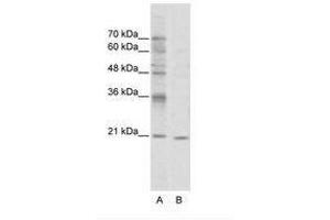 Image no. 1 for anti-Visual System Homeobox 1 (VSX1) (N-Term) antibody (ABIN202105)