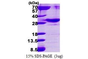 Image no. 1 for RAB34, Member RAS Oncogene Family (RAB34) (AA 1-259) protein (His tag) (ABIN667981)