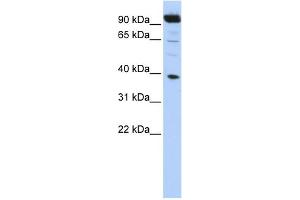 Image no. 1 for anti-Homeobox B2 (HOXB2) (N-Term) antibody (ABIN2776384)