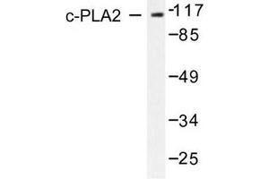 Image no. 2 for anti-Phospholipase A2, Group IVB (Cytosolic) (PLA2G4B) antibody (ABIN271921)