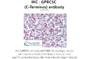 Image no. 1 for anti-G Protein-Coupled Receptor, Family C, Group 5, Member C (GPRC5C) (C-Term), (Cytoplasmic Domain) antibody (ABIN1735219)