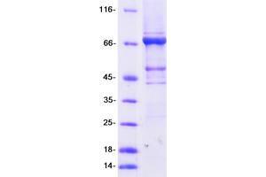 Image no. 1 for tRNA Methyltransferase 2 Homolog A (TRMT2A) (Transcript Variant 1) protein (Myc-DYKDDDDK Tag) (ABIN2734358)