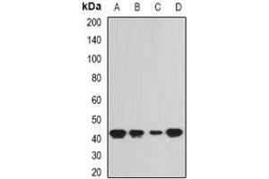 Image no. 2 for anti-Selenophosphate Synthetase 1 (SEPHS1) antibody (ABIN2967021)