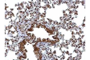IHC-P Image BCL7A antibody [C2C3], C-term detects BCL7A protein at nucleus on mouse lung by immunohistochemical analysis.