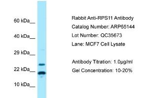 Image no. 1 for anti-Ribosomal Protein S11 (RPS11) (N-Term) antibody (ABIN2790057)