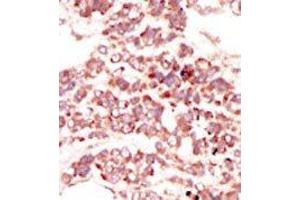 Image no. 2 for anti-PTK7 Protein tyrosine Kinase 7 (PTK7) (N-Term) antibody (ABIN360111)