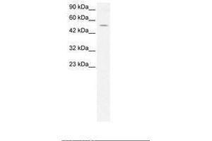Image no. 2 for anti-EVX1 (EVX1) (AA 74-123) antibody (ABIN202451)