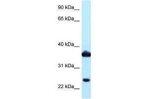 Image no. 2 for anti-Aldo-Keto Reductase Family 1, Member C3 (3-alpha Hydroxysteroid Dehydrogenase, Type II) (AKR1C3) (N-Term) antibody (ABIN2788802)