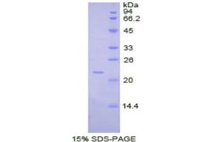 Image no. 1 for Interleukin 1 alpha (IL1A) (AA 98-266) protein (His tag) (ABIN1877686)