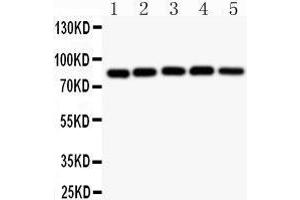 Image no. 2 for anti-conserved Helix-Loop-Helix Ubiquitous Kinase (CHUK) (AA 411-745) antibody (ABIN3043812)