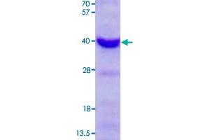 Image no. 1 for Charged Multivesicular Body Protein 4A (CHMP4A) (AA 1-265) protein (His tag) (ABIN5569576)