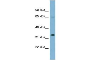 Image no. 1 for anti-Ha-Ry/enhancer-of-Split Related with YRPW Motif 1 (HEY1) (Middle Region) antibody (ABIN2776825)