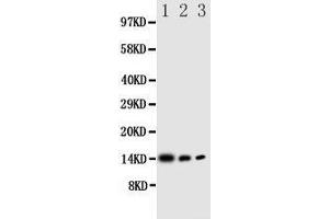 Image no. 1 for anti-Interleukin 4 (IL4) (AA 72-88), (Middle Region) antibody (ABIN3044141)